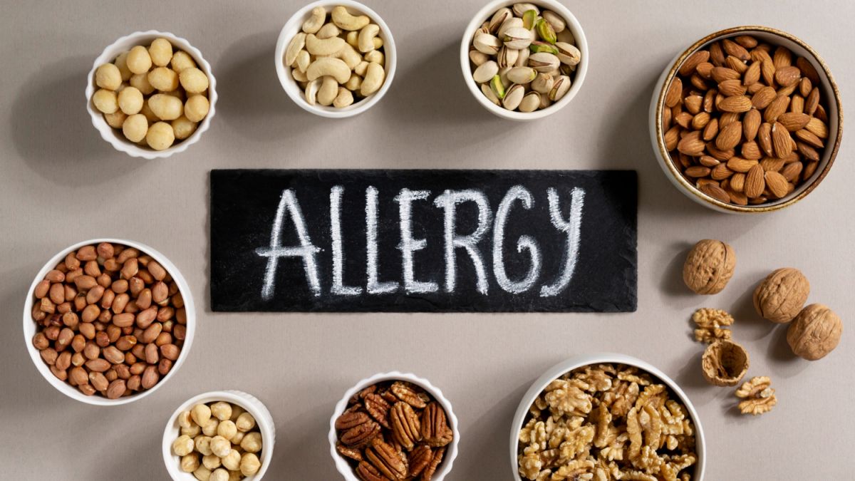 Vida cotidiana com alergias - as pessoas alérgicas precisam prestar atenção a estes pontos quando se trata de alimentos